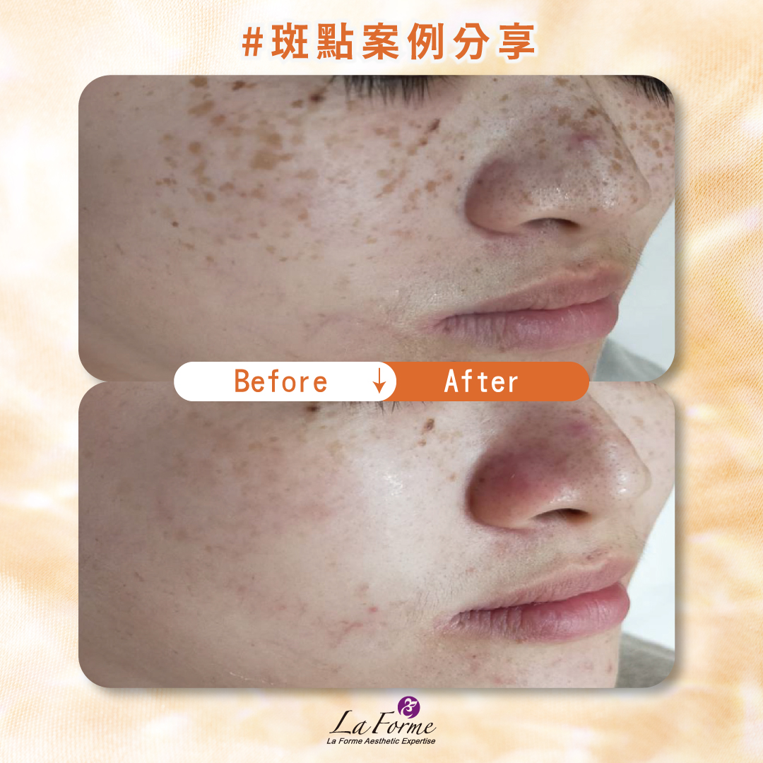 斑點官網分享-01