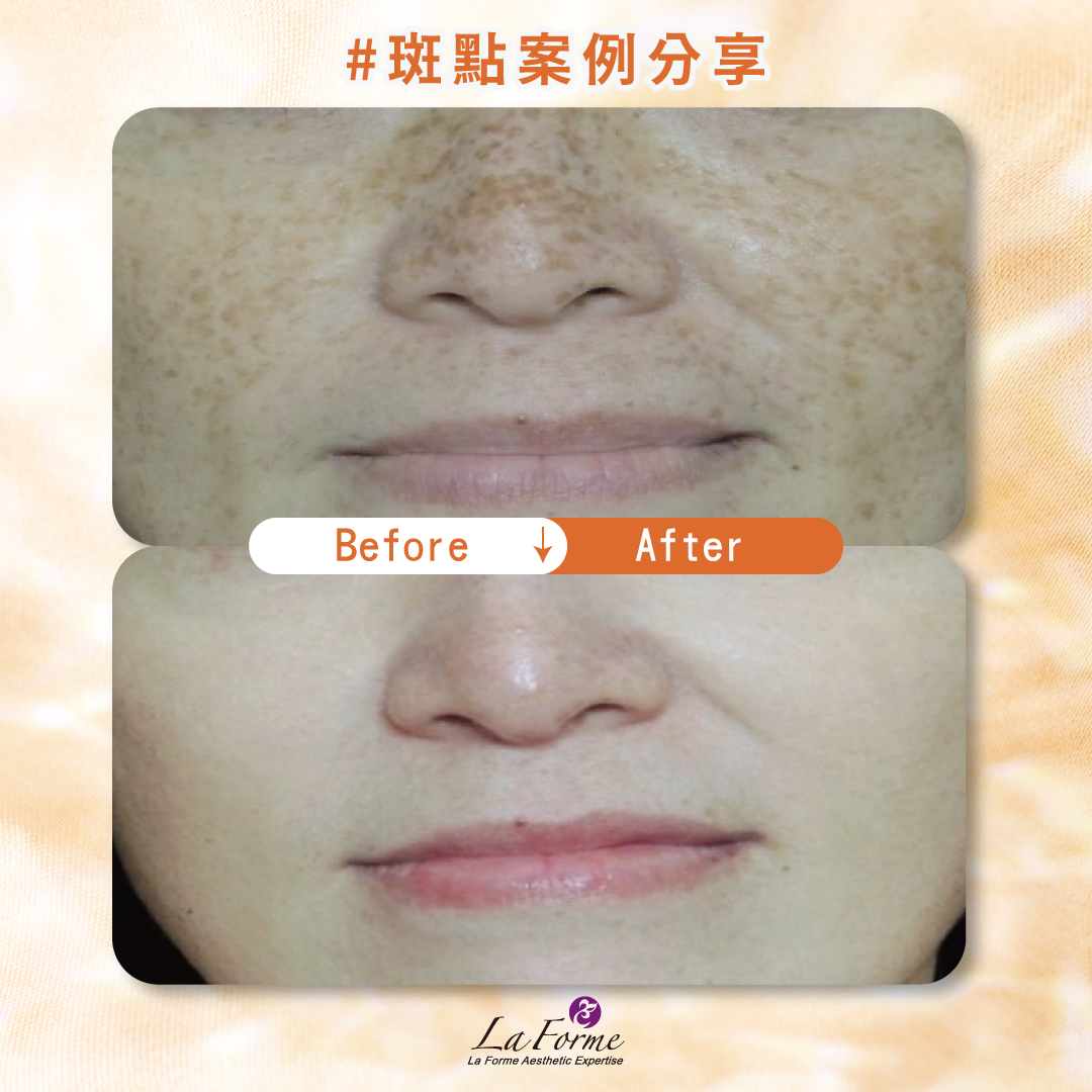 斑點官網分享-02