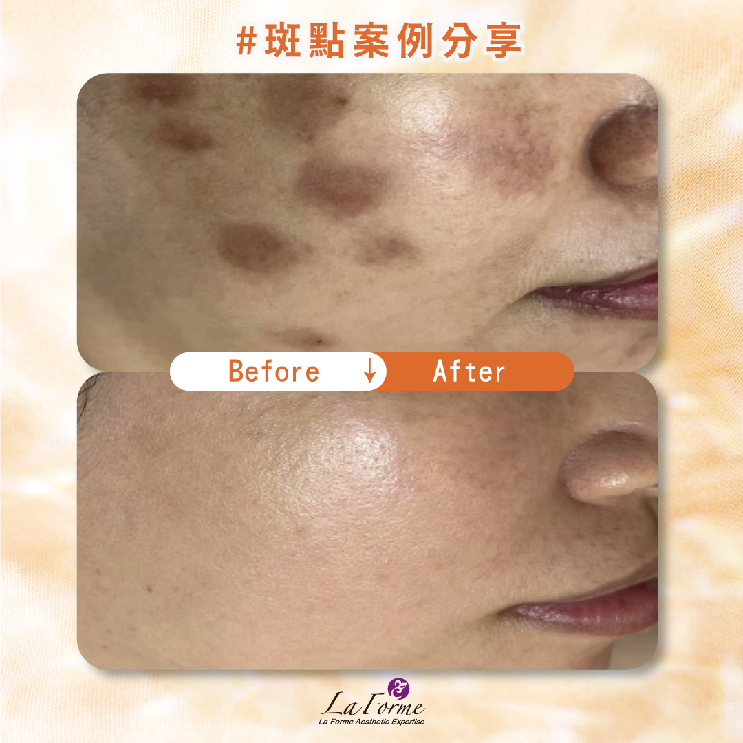 斑點官網分享-03